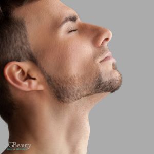 laser hair removal for men